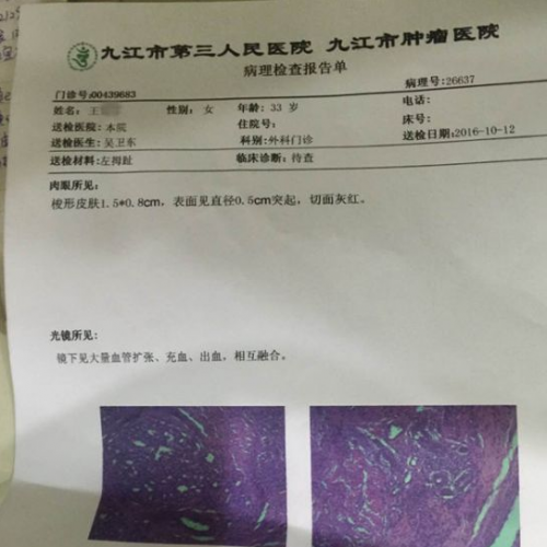 市民曝其脚趾上长了血管瘤 修脚店当肉刺处理险致烂脚
